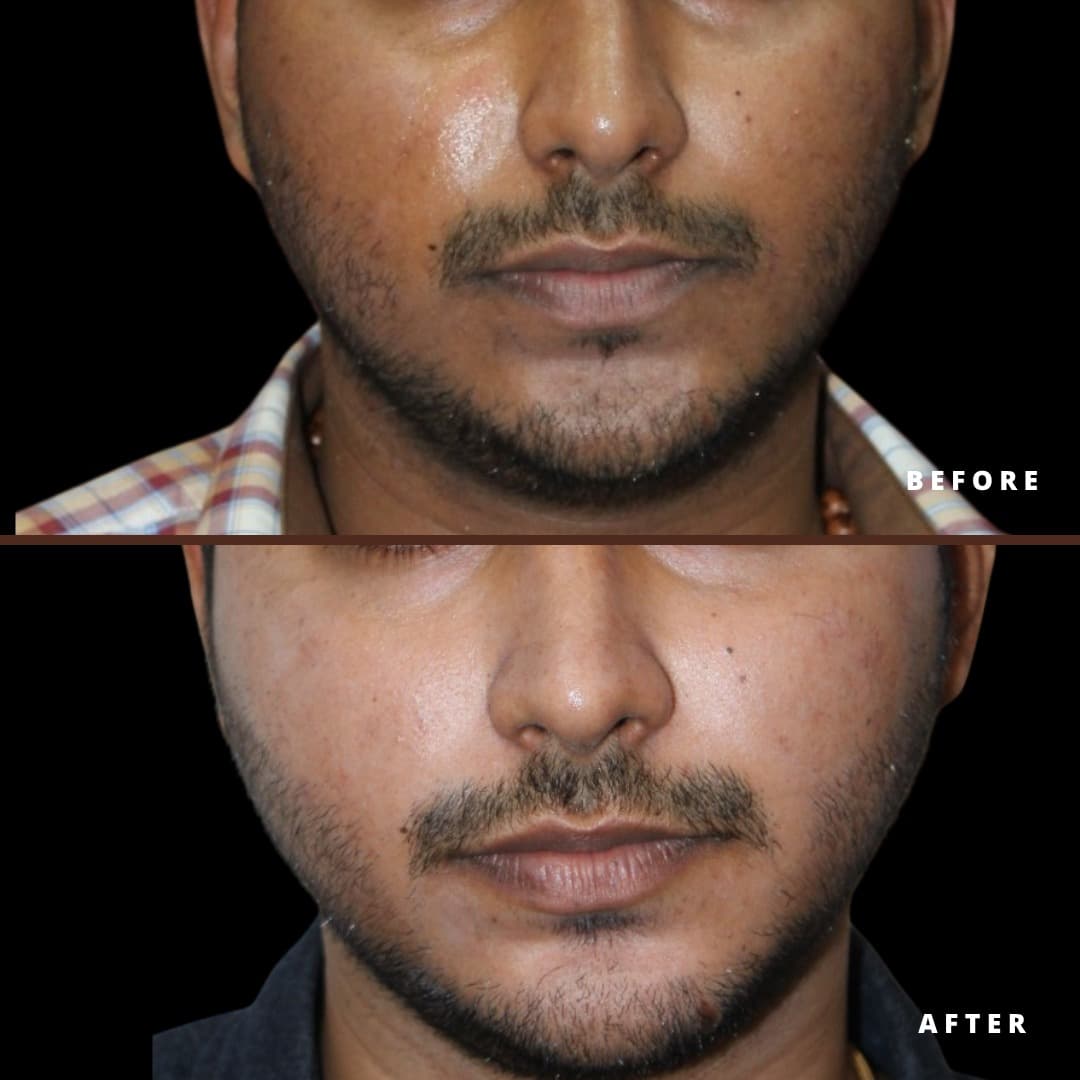 In-clinic IV therapy results