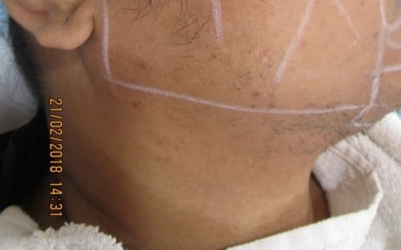 After, Pre-event radiance & tone brightening