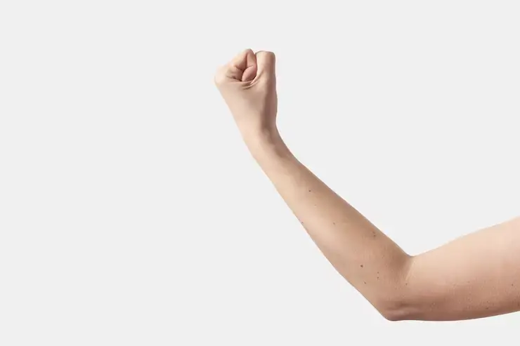 Arms
