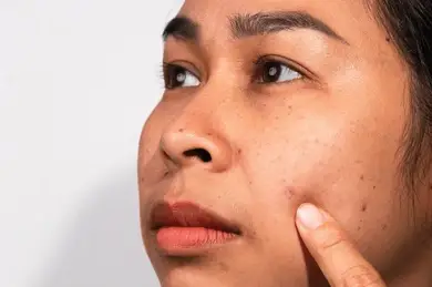 Dull & tired skin