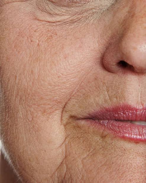 Anti-Ageing