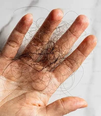 Hair Fall