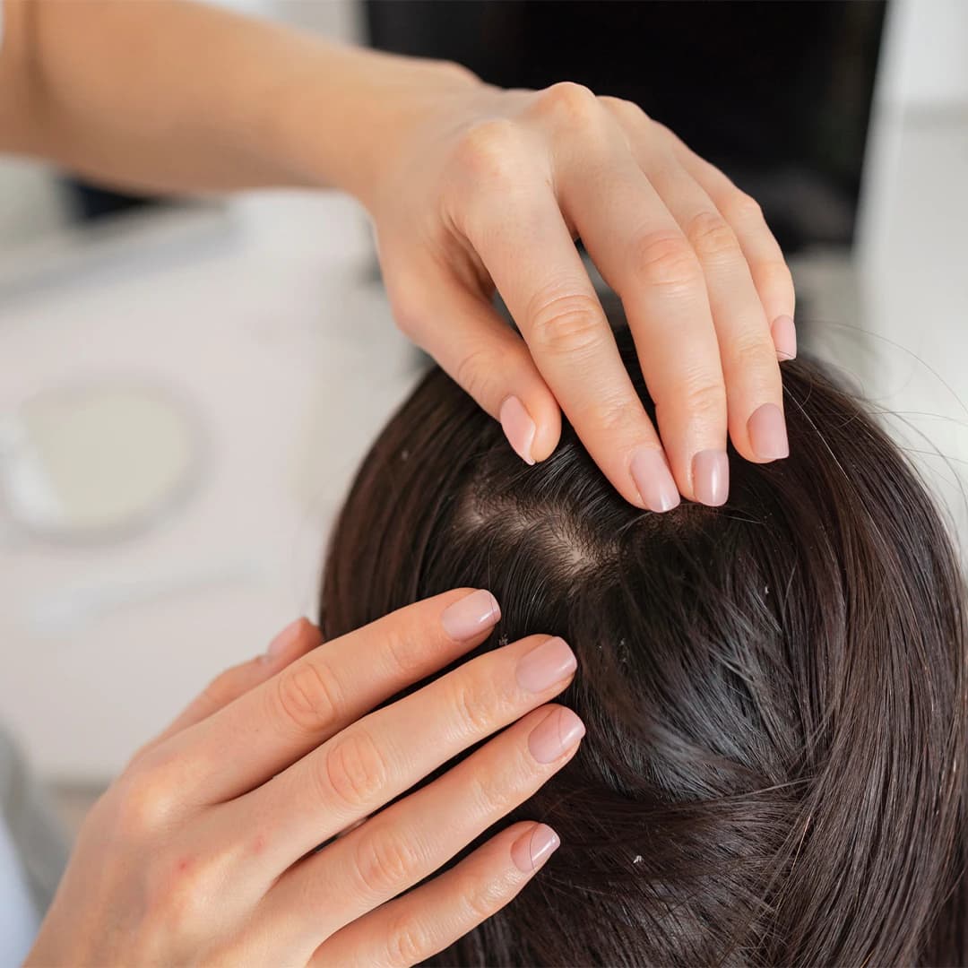 Hair Regrowth